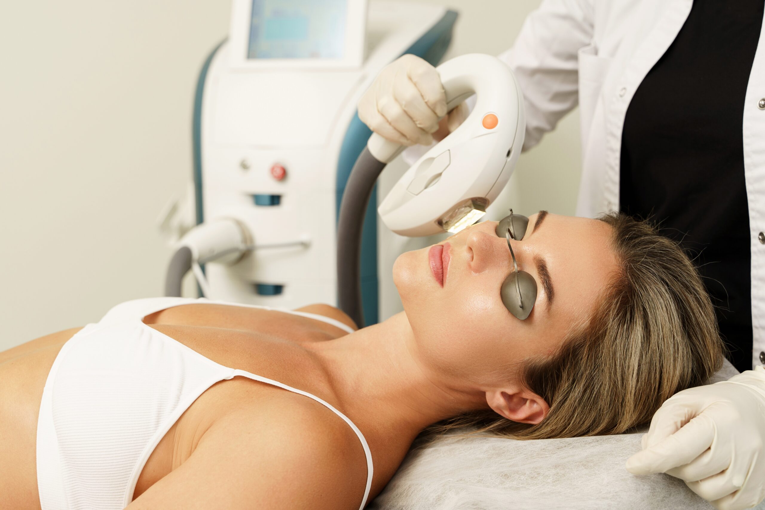 Photofacial IPL