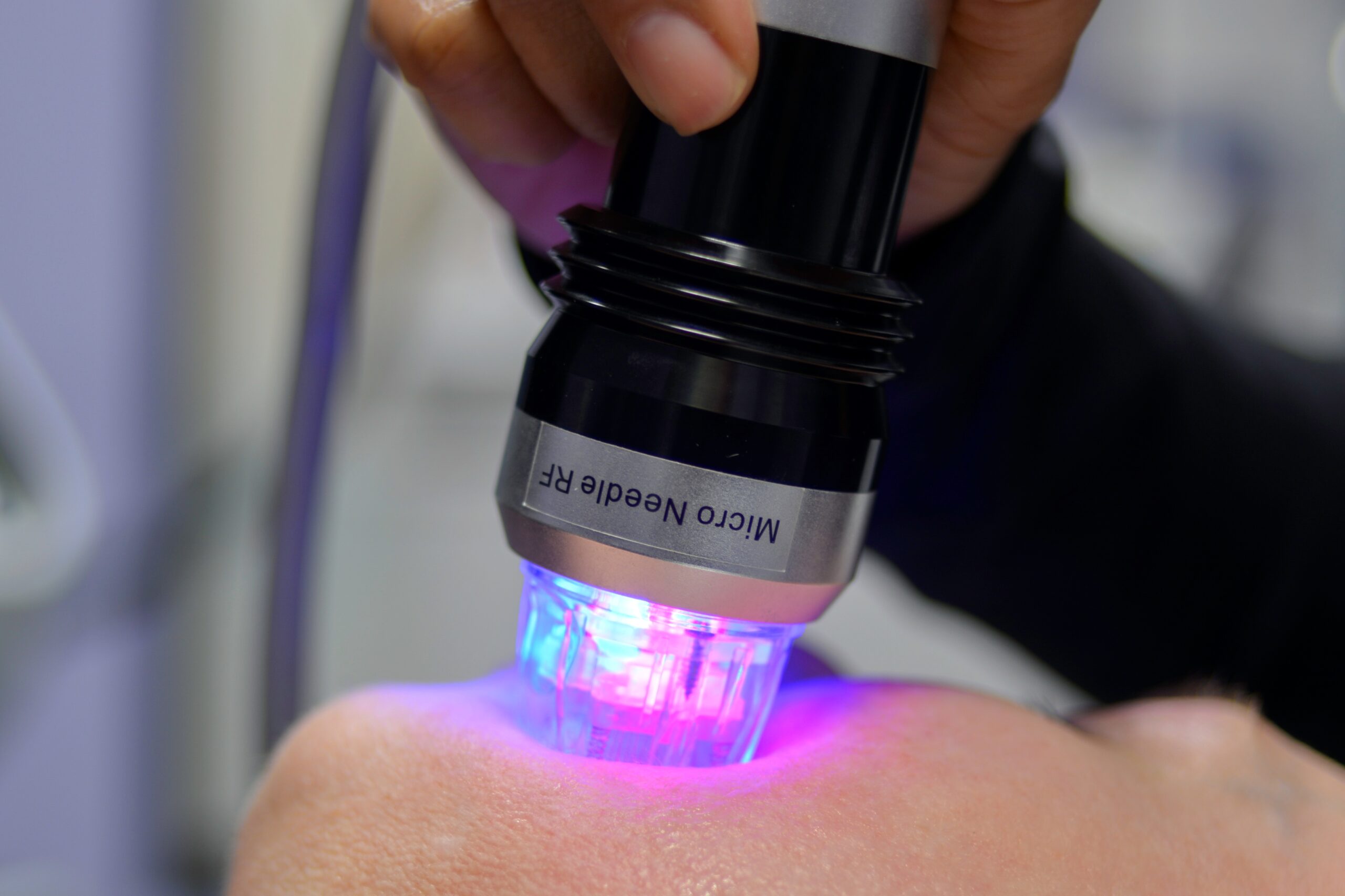 RF Microneedling at Genesis Spa MD